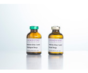 0040 0050 HPLC endocrine urine controls