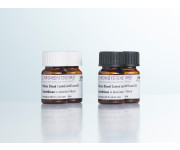 0077 0078 0079 HPLC glutathione whole blood controls