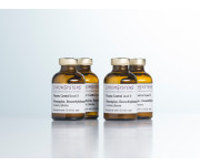0147 0148 0149 HPLC olanzapine desmethylolanzapine plasma controls