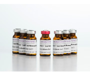 80739 LCMS 6PLUS1 total metanephrines urine